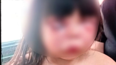 Imperdonable: un hombre le desfiguró la cara a golpes a una nena de 7 años